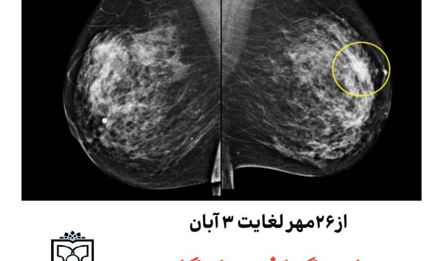ماموگرافی رایگان ویژه عموم همشهریان بمناسبت هفته سلامت بانوان