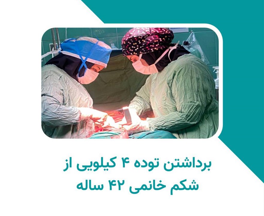 برداشتن توده ۴ کیلویی از شکم خانمی ۴۲ ساله